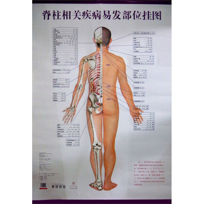 [M]脊柱相关疾病易发部位挂图-9787513224420