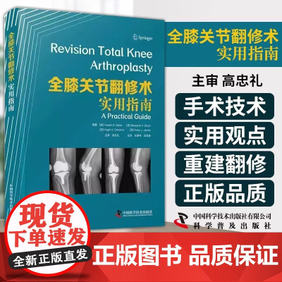 DF[央视网]全膝关节翻修术:实用指南复杂初次全膝关节置换术 全膝关节翻修术的适应证 旋转饺链假体整形手术 中国科学技术