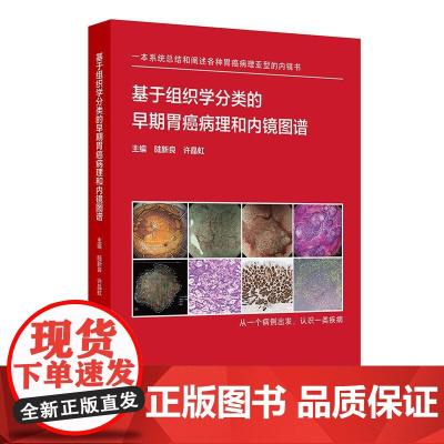 基于组织学分类的早期胃癌病理和内镜图谱 陆新良 许晶虹编 系统阐述各种病理亚型早期胃癌内镜病理特征97871173660