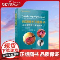 [央视网]前路髋关节置换术 从起源到现代先进技术 国际经典骨科学译著 本书引进自Springer出版社 是一部前路髋关节