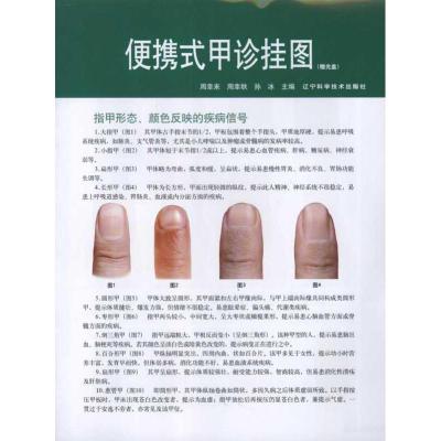 [N]便携式甲诊挂图(赠光盘)-9787538172102