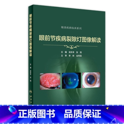 [正版]眼前节疾病裂隙灯图像解读实用学中华眼科特检照相技巧青光眼 角膜屈光手术并发症案例图解眼表疾病临床诊断视网膜医学