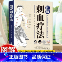 图解耳针疗法 [正版]图解刺血疗法刺血疗法刺血疗法书籍中国刺血疗法刺血疗法治百病刺血疗法速成图解图解刺血疗法中国刺血疗法