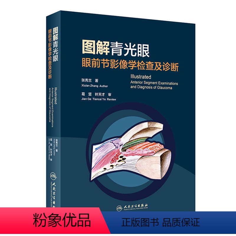 [正版]图解青光眼 眼前节影像学检查及诊断 张秀兰 青光眼诊断 房角镜 UBM OCT 裂隙灯激光虹膜葡萄膜炎人民卫生