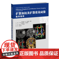 书]扩散加权及扩散张量成像:临床指南 影像医学 脑水肿 早期脑发育 创伤性脑损伤血管病变 头颈部病变 儿童脑白质病变