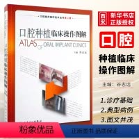[正版]口腔种植临床操作图解 人民卫生出版社 谷志远 拔牙技巧学义齿全瓷修复颌面外科正畸黏膜病学牙髓之路 口腔医学书籍