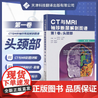书]CT与MRI袖珍解剖断层图谱第一卷头颈部 医学影像诊断学 头影测量ct读片ct诊断临床 脑部血管造影术天津科技翻译出