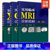 [正版]全3册实用临床MRI线诊断图解+X线诊断图解+CT诊断图解(第二版) mri影像诊断学 临床读片指南核磁共振书