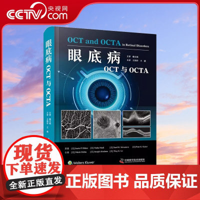 [央视网]眼底病OCT与OCTA 以言简意赅的表达形式对不同眼底疾病的影像特征进行细致描述 并配有丰富的图片资料ZK