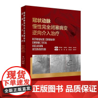 冠状动脉慢性完全闭塞病变逆向介入治疗 逆向介入对心血管造影 适应证判断 微通道建立 张斌等 人民卫生出版社9787117