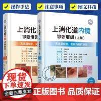 [单本任选]2册 上消化道内镜诊断培训 上卷+上消化道内镜诊断培训 下卷2册 发现病变的诀窍 医药卫生书籍 辽宁科技出版