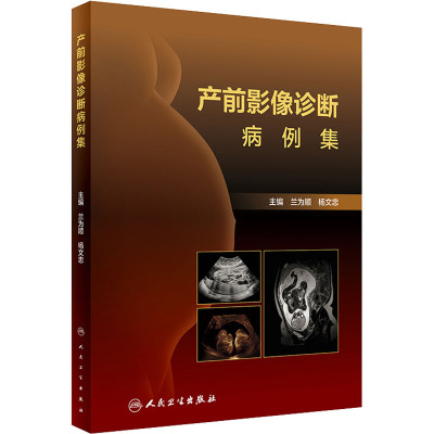 产前影像诊断病例集