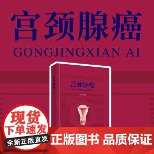 新书 《宫颈腺癌》子宫颈疾病--癌--防治