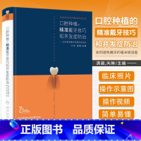 [正版] 口腔种植的精准戴牙技巧和并发症防治 如何避免戴牙的毫米级误差 植入技巧满毅二期手术和取模技巧手术学图解前后牙
