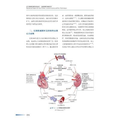 心力衰竭机械支持治疗:当前策略与新技术