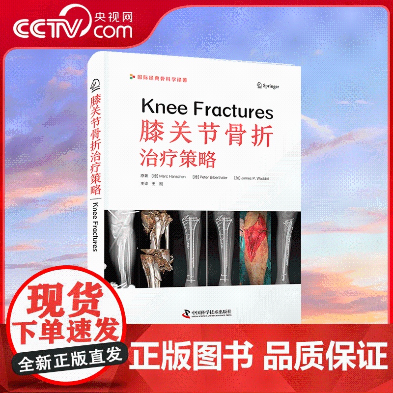 [央视网]膝关节骨折治疗策略 关于膝关节及其周围骨折和相关损伤的综合指南 ZK