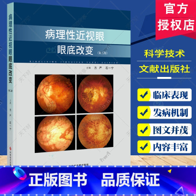 单本全册 [正版]病理性近视眼眼底改变第2二版 方严 石一宁主编 病理性近视眼底改变的分类及演变存在的各种眼底改变 科学