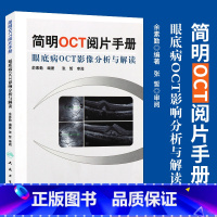 [正版] 简明OCT阅片手册 眼底病眼科OCT影像分析与解读 俞素勤编著 基础阅片影像眼科学视光技术应用 人民卫生出版