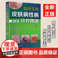 临床实用皮肤病性病诊疗图谱(第2版)病毒性皮肤病 细菌性真菌性动物性物理性皮肤病 皮肤科医师研究生医学生全科医师参考书籍