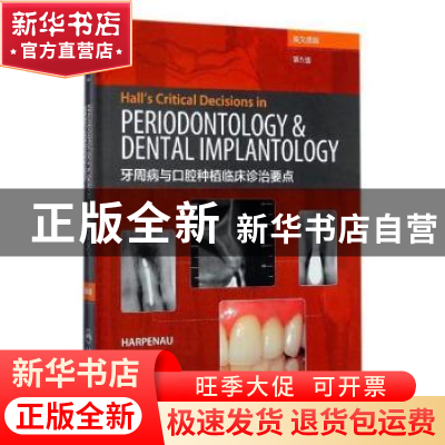正版 牙周病与口腔种植临床诊治要点 丽莎.A.哈本诺 人民卫生 978