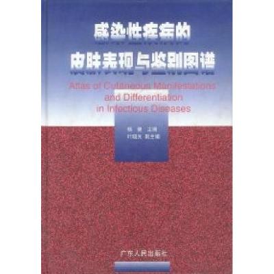 正版新书]感染性疾病的皮肤表现与鉴别图谱杨健9787218031286