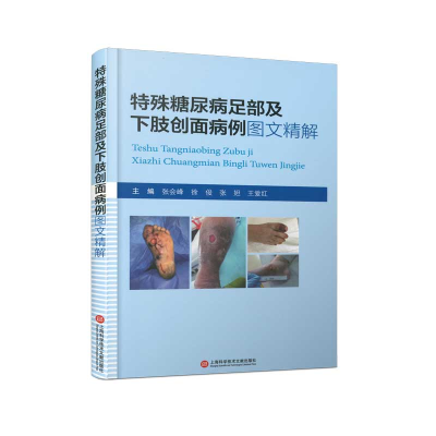 正版新书]特殊糖尿病足部及下肢创面病例图文精解张会峰 等 编97