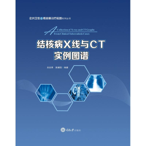 [M]结核病X线与CT实例图谱-9787568909198
