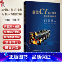 能量CT前沿技术与临床专病应用 常规CT的局限性和能量CT成像原理 基于球管的技术 主编月强 姚晋 胡娜9787117