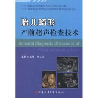 [M]胎儿畸形产前超声检查技术-9787502367657