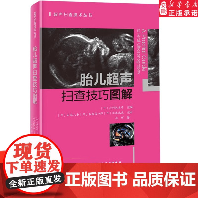 胎儿超声扫查技巧图解 胎儿 超声 扫查技巧图解 覆盖ISUOG孕期筛查全路径实用指导书 胎儿超声波检查 正版书籍
