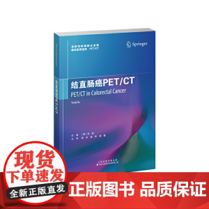 结直肠癌PET/CT