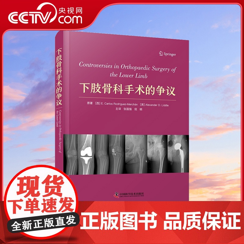 [央视网]下肢骨科手术的争议 一部专门分析近年来有关下肢关节矫形手术方面各种关键争议性问题的著作ZK