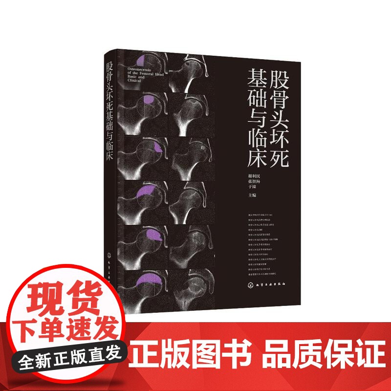 股骨头坏死基础与临床 谢利民、张智海、于潼 主编 9787122475930