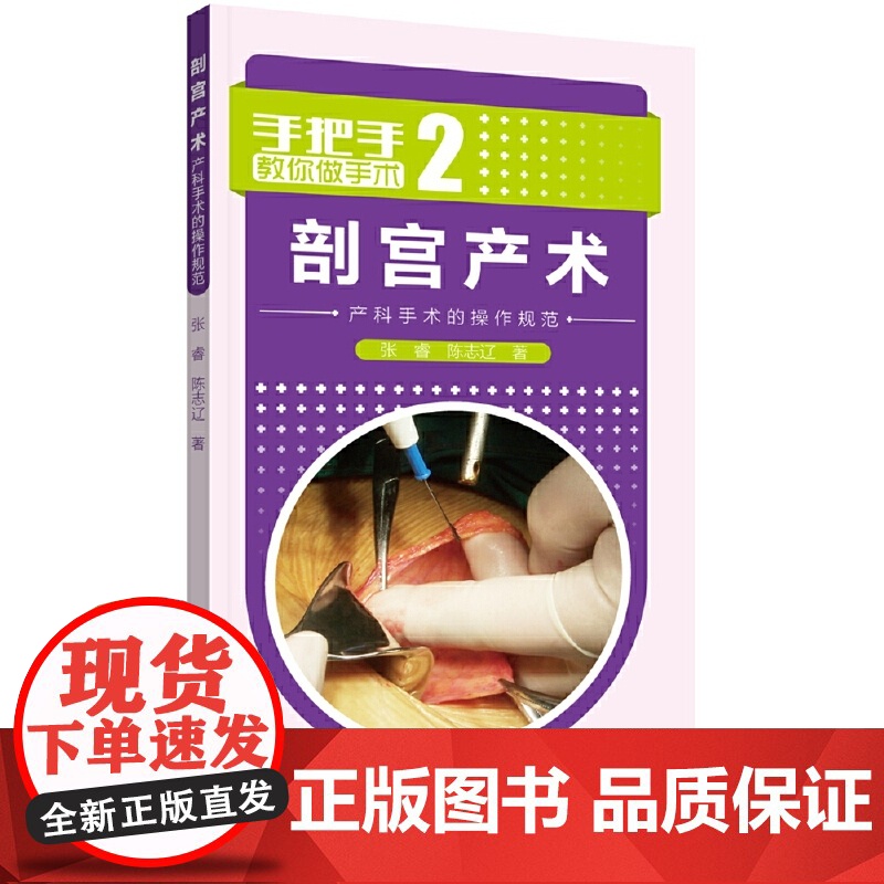 剖宫产术:产科手术的操作规范