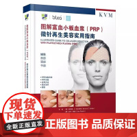 图解富血小板血浆(PRP)微针再生美容实用指南(德)伯纳德·C.科尔斯特 主编 附加内容二维码 978755914057
