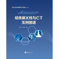 音像结核病X线与CT实例图谱吕圣秀,陈耀凯编著