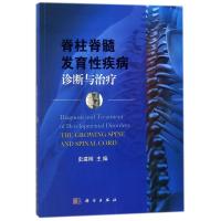 脊柱脊髓发育性疾病诊断与治疗