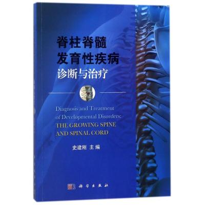 脊柱脊髓发育性疾病诊断与治疗