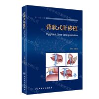 [N]背驮式肝移植(精)-9787117337618