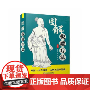 图解拔罐疗法