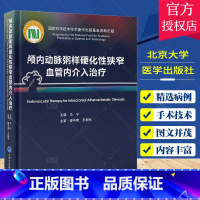 单本全册 [正版]颅内动脉粥样硬化性狭窄血管内介入治疗 马宁 中英双语对照 ICAS研究血管内治疗技术临床精选病例978