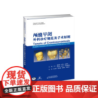 颅缝早闭外科诊疗规范及手术原则 王占祥郭剑峰陈四方谭国伟 当代颅缝早闭畸形手术治疗及处理的实践指南