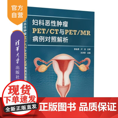 [正版新书]妇科恶性肿瘤PET/CT与PET/MR病例对照解析 孙洪赞 清华大学出版社 影像医学 妇科学 肿瘤学