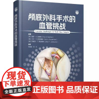 颅底外科手术的血管挑战 刘宏毅 刘永 主译 头颈部和Willis环的血管解剖 颅底肿瘤的栓塞治疗等 9787559141