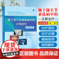 颞下颌关节紊乱病中的正畸治疗病例精解 世界图书出版公司9787523222935