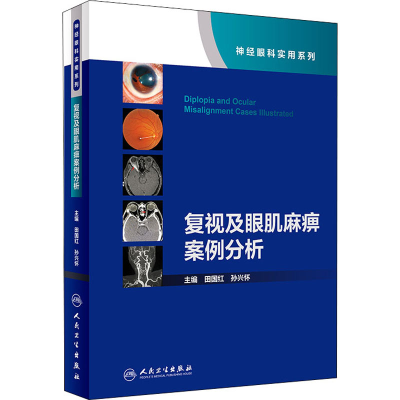 [M]复视及眼肌麻痹案例分析-9787117305334
