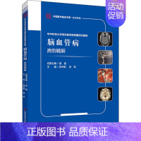 [正版]华中科技大学同济医学院附属同济医院脑血管病病例精解 张华楸,舒凯 编 内科学疾病诊治资料图书 医学类书籍 科学技