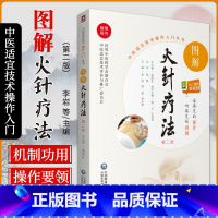 [正版]无视频-图解火针疗法中医适宜技术民间传统jue学火针疗法操作入门
