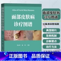 面部皮肤病诊疗图谱 [正版] 面部皮肤病诊疗图谱 高清典型520余幅照片 注于面部损容性疾病诊疗的专业图谱 看图识病 广