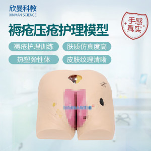 欣曼科教 高级褥疮压疮护理模型 压疮病情演变仿真模型XM-H90